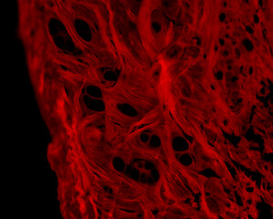 Collagen fibers, picro sirius red, fluorescence microscopy