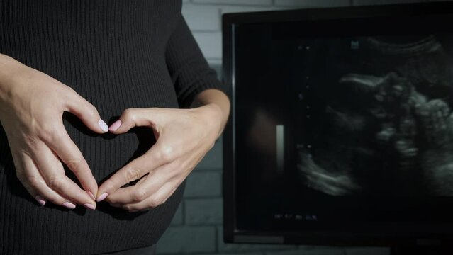 Holding pregnant stomach in heart shape gesture. A view of female hands in heart shape on pregnant belly against ultrasound picture with embryo.