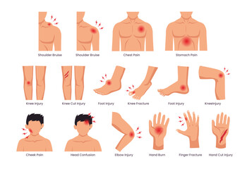 Set of physical injury set collection, Cartoon physical injury, wound bandage application, bandaged human body parts, treated wounds, fractures treatment, Hurt and injury, vector illustration. - obrazy, fototapety, plakaty