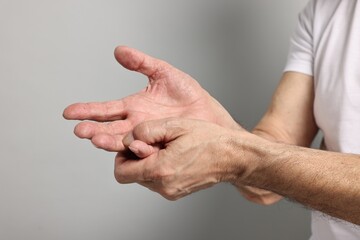 Arthritis symptoms. Man suffering from pain in hand on gray background, closeup