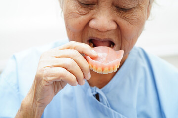 Asian senior woman patient holding teeth denture in her hand for chew food.