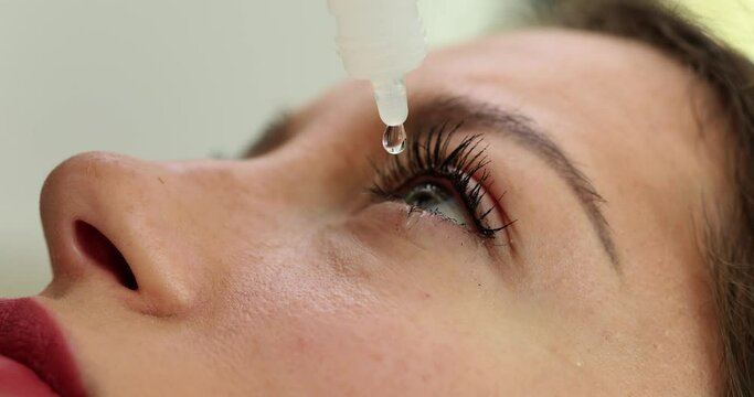 Closeup of a woman applying eye drops to eye