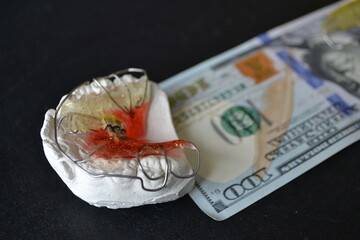 Plaster cast of teeth and dental plate