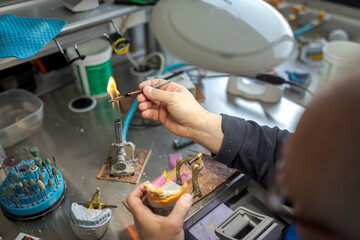 Dental Technician Molds a Dental Crown in Wax. Prosthetics and Production of Model Teeth in...
