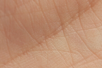 Texture of dry skin as background, macro view