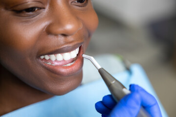 Multicultural woman visiting dentist for teeth treatment