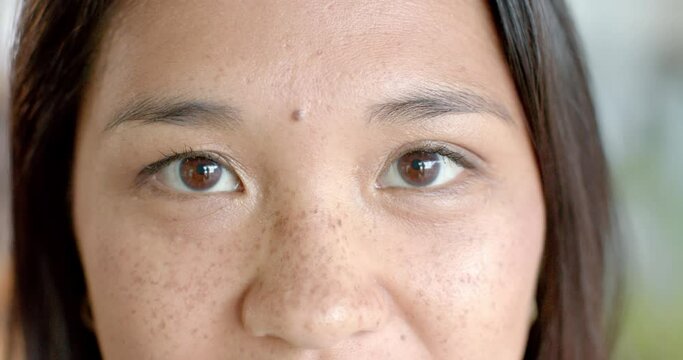 Close-up of an Asian woman's face, highlighting her eyes and freckles