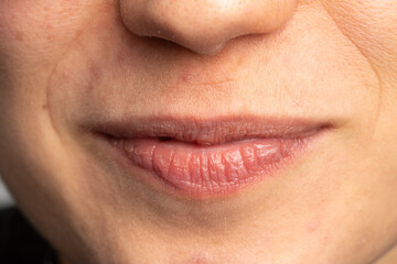 close-up of a person's lips showing natural texture and details