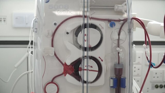 Close-up of a blood dialysis machine pumping to filter blood.