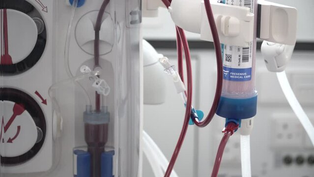 Close-up of filtered blood going through a dialyzer, dialysis machine in hospital.