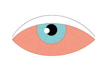 Eye sore line icon, disease and allergy, eye redness 