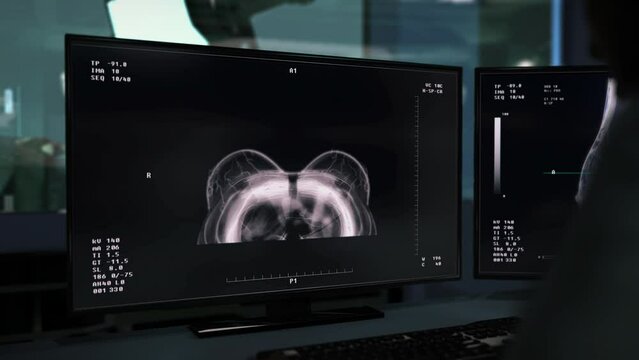 Doctor Uses Mammogram To Scan Patient And Prevent Breast Cancer. Doctor Checks For Cancer Illness With Advanced Analysis Program. Preventing Disease. Doctor Examines X-ray To Prevent Cancer