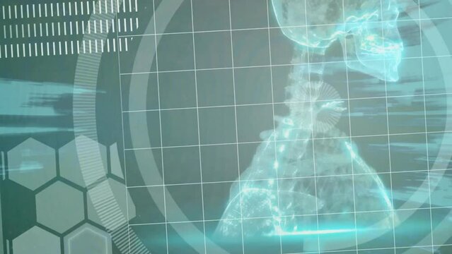 Animation of medical interface screen with skeleton and brain processing data on dark background