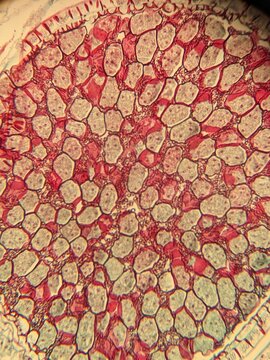 The Sporophyte of Pellia tissue under the microscope