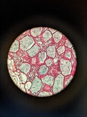 The Sporophyte of Pellia tissue under the microscope