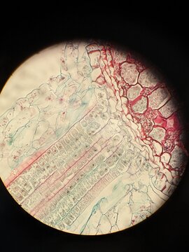 The Sporophyte of Pellia tissue under the microscope