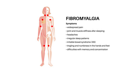 Fibromyalgia medical poster