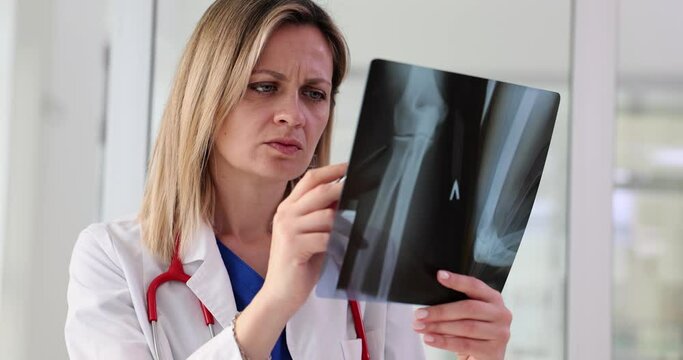 Traumatologist examines x-rays of bones of elbow and arm