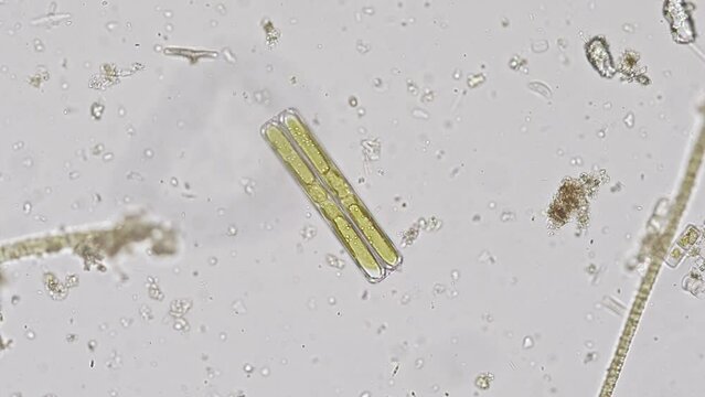 Pinnularia diatom algae under the microscope - optical microscope x200 magnification