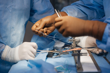 surgeons work on the cut part of the knee joint (muscular ligament). Arthroscopic anterior cruciate...