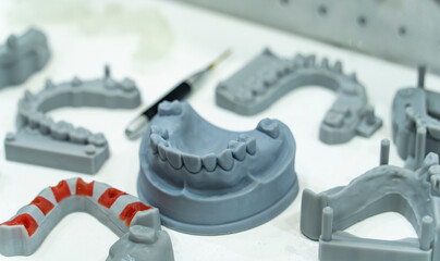 lower jaw of a man created on a 3d printer