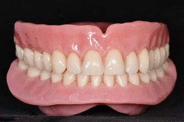 Frontal view of a complete dental prothesis