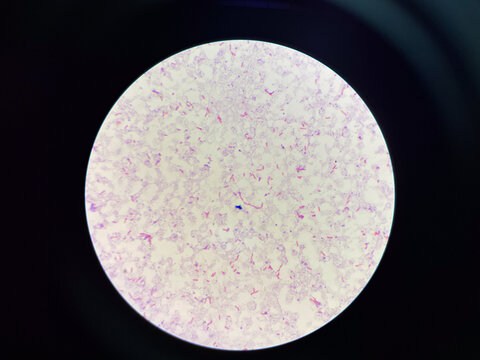 red cell Gram negative bacilli in hemoculture.