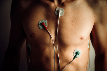 Heart monitor, EKG, cardio recording placed on the body of a young man. A medical tool for monitoring heart rate and overall heart health. Electrocardiogram in natural light - 749255566