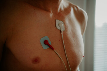 Cardio health revealed: Natural light illuminates the intricate patterns of an EKG on the physique of a youth - 749255939