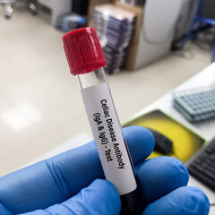 Blood sample tube for celiac disease antibodies test, help diagnose celiac disease and to evaluate the effectiveness of a gluten-free diet