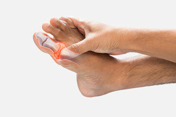 Gout or inflammatory arthritis.