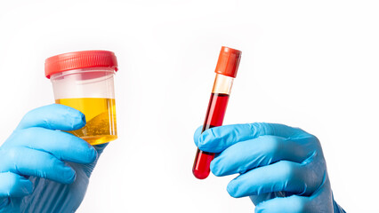 Blood and urine tests in doctor's hands, Doctor holding urine and blood samples for test close-up. - obrazy, fototapety, plakaty