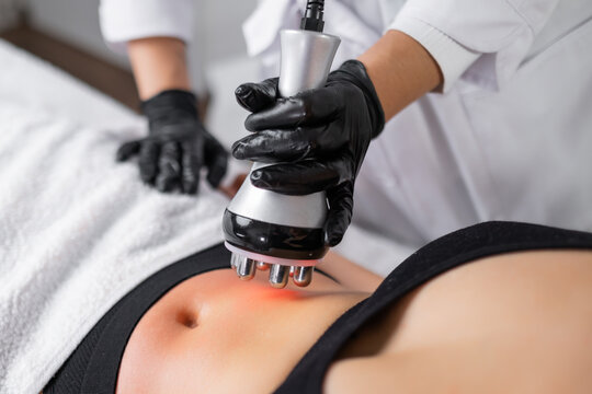 A skilled cosmetologist doing RF skin tightening and body contouring treatments to enhance the youthful allure of a clients abdomen. 