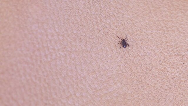 parasite tick, mite from order Ixodidae, blood-sucking parasites crawls on skin, Acariformes, carrier of dangerous disease encephalitis, surveillance systems, tick-borne disease prevention strategies