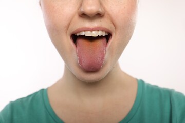 Gastrointestinal diseases. Woman showing her yellow tongue on white background, closeup