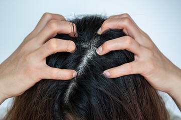 Cropped shot view of Asian woman scratching her scalp.