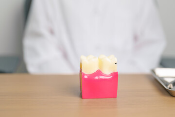 Dentist with tooth Anatomy model. Oral Teeth decay and disease, Scrape off tartar. March Oral health, Dentist Day, False Teeth. Toothache and Children Dental Health Month and Orthodontic Health Day