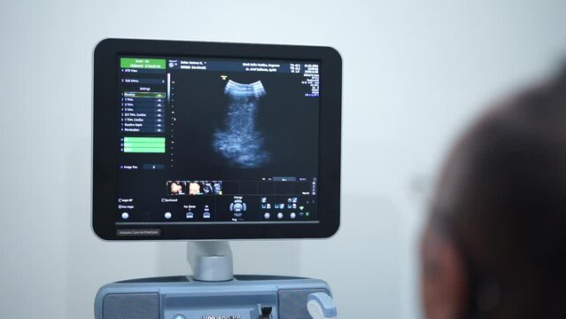 Doctor operating Ultrasonography (USG) tools for pregnant woman