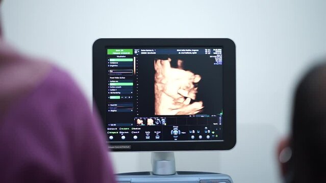 Doctor operating 4D Ultrasonography (USG) tools for pregnant woman