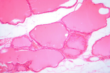 Thyroid gland under a microscope, light micrograph exhibiting typical follicular structure and colloid-filled follicles