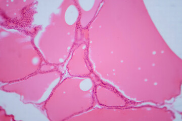 Thyroid gland under a microscope, light micrograph exhibiting typical follicular structure and colloid-filled follicles