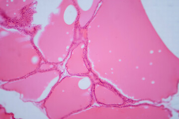 Thyroid gland under a microscope, light micrograph exhibiting typical follicular structure and...