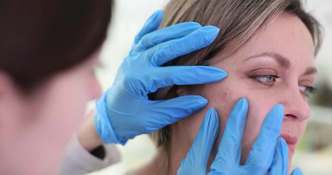 Doctor dermatologist examining eroded neoplasm on facial skin of female patient closeup 4k movie. Diagnosis and treatment of malignant and benign skin tumors concept