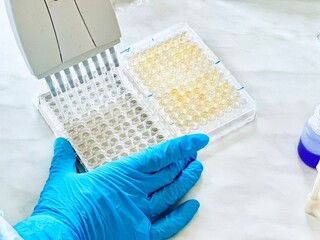Enzyme-linked immunosorbent assay (ELISA) 96 well micro plate, Immunology or serology testing...