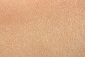 Texture of dry skin as background, macro view