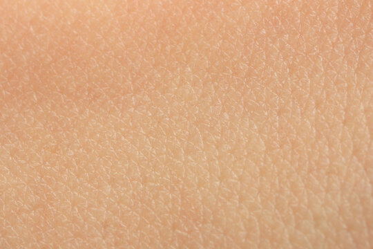 Texture of dry skin as background, macro view