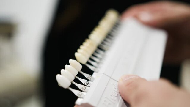 Dentist showing patient a teeth whitening shade chart.