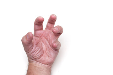 Furious Hand: Expressions of Anger and Frustration