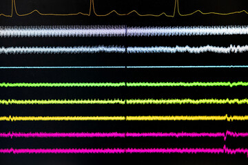 Monitor displaying colorful neon lines on black surface