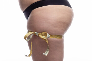 Fragment of a feminine figure with excess weight and cellulite on her legs in black panties and...